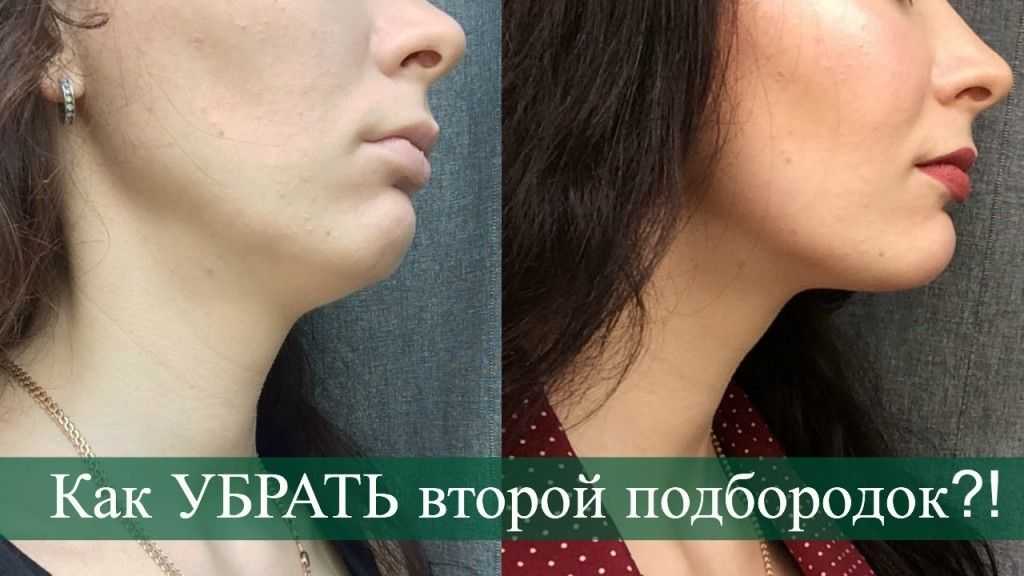 Советы и хитрости по ретуши фото
